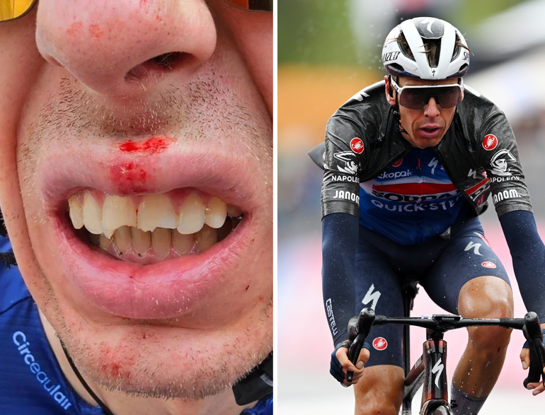 Woede in Tour de France na bizarre valpartij: renner breekt drie tanden door toeschouwer