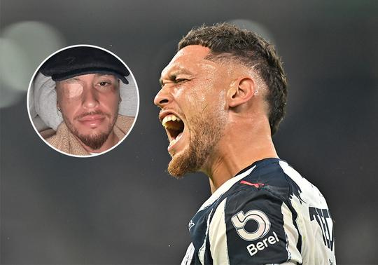 Argentijnse Ajax-flop (31) onthult akelige gezichtsverlamming: 'Januari wordt beter'