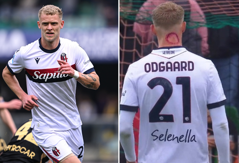 Voormalig AZ-speler Jens Odgaard moet bloedige 'zombiebeet' verklaren: 'Geen paniek'