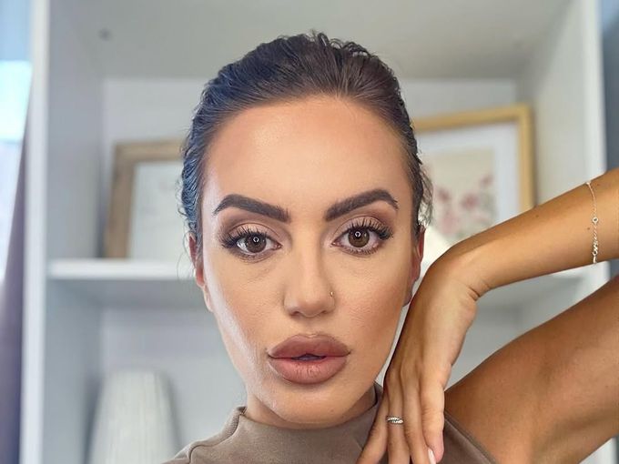 Граченова от "Traitors: Игра на предатели" след ринопластиката: Нося си старите травми (Снимка)