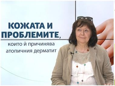 Код здраве: Как да се справим с атопичния дерматит през пролетта и лятото?