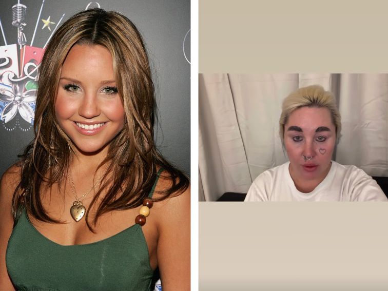 Какво направи Холивуд с нея? Аманда Байнс, Оземпик и новата ѝ визия