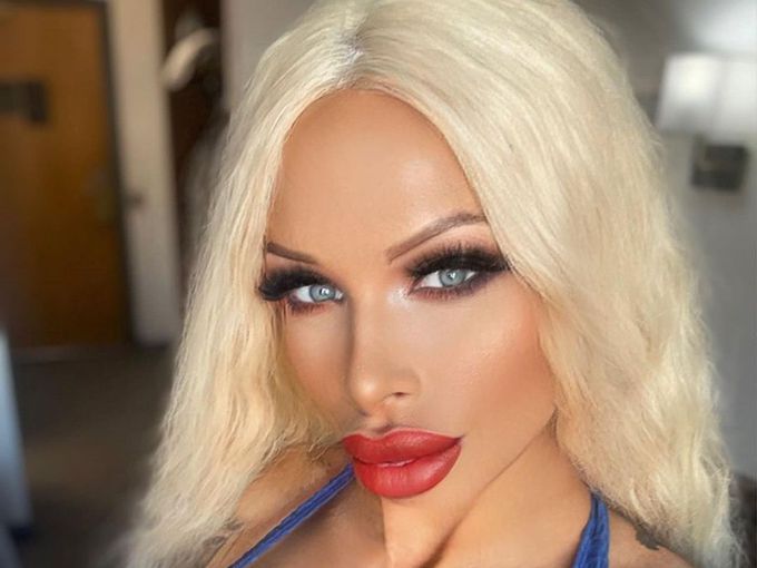 Порноактриса умря заради проблем със силикона