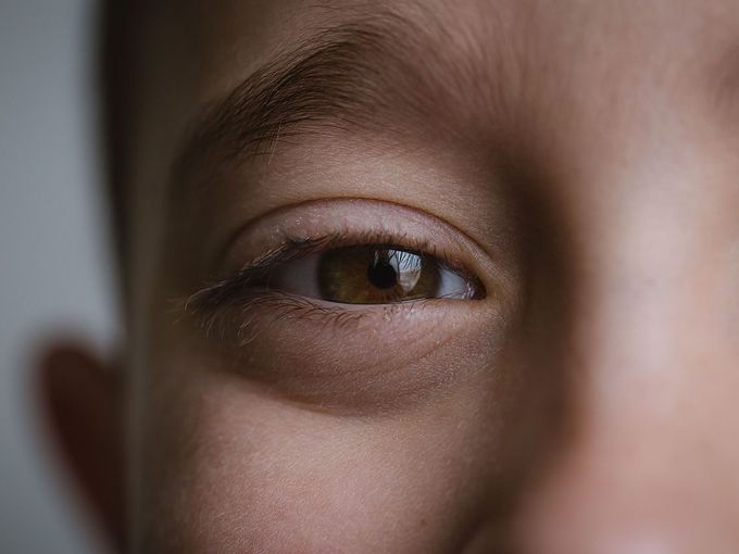 Снежна слепота: Как да я разпознаете и какво никога не бива да правите