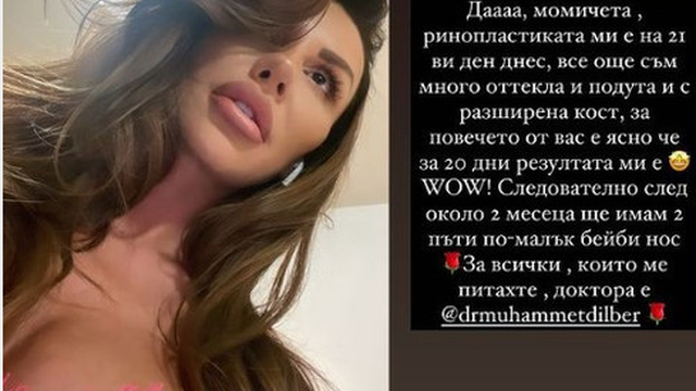 Моника Валериева с първи кадри след операцията на носа