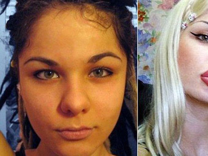 Жената с най-големите силиконови устни