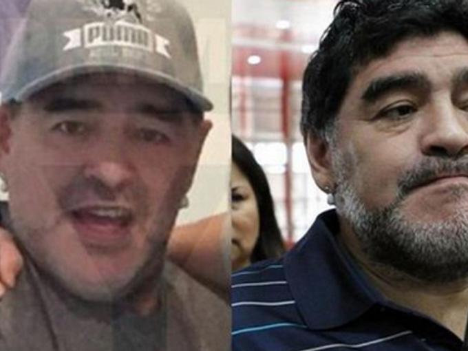 Марадона се подложи на фейслифтинг