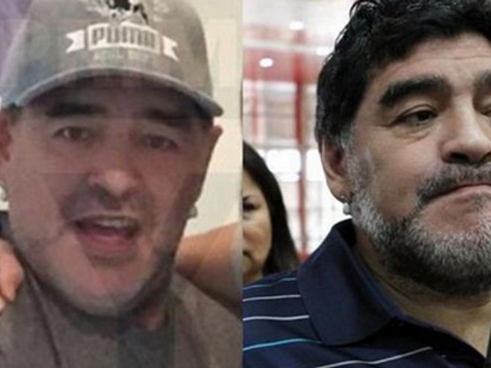 Марадона се подложи на фейслифтинг