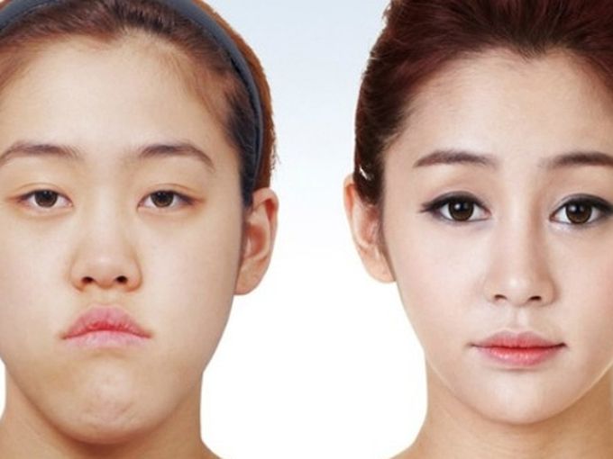 Неузнаваеми след пластични операции (снимки)