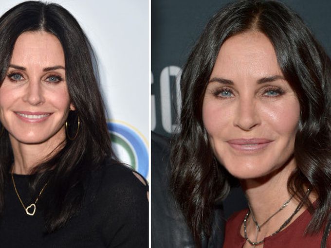 Защо Кортни Кокс скъса с пластичните операции?