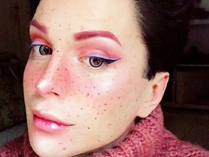 Счупена челюст и хиляди долари: Цената да приличаш на елф!