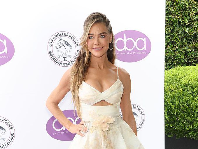 Край на спекулациите и "пуешката шия": Денис Ричардс разкри какво е направила с лицето си