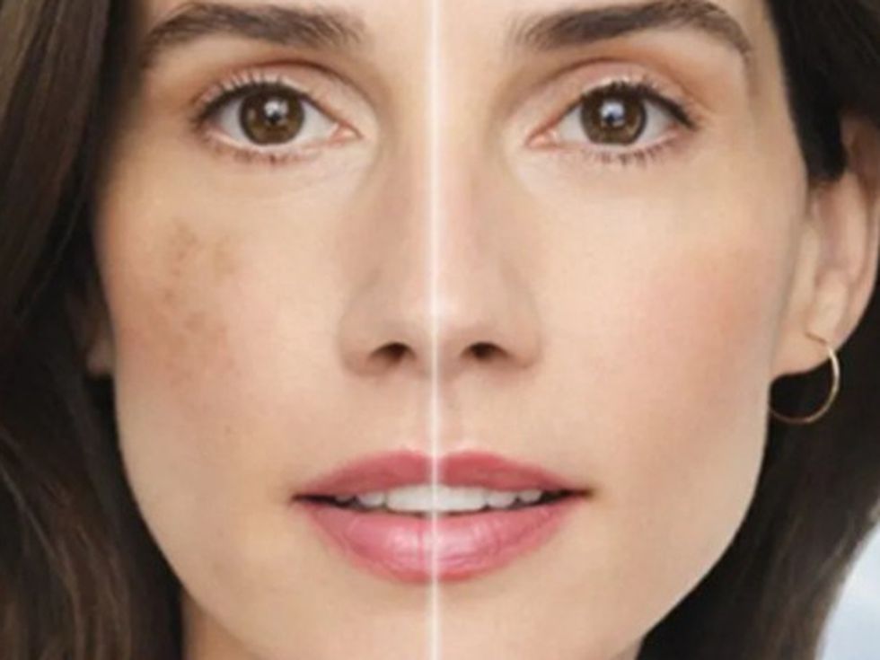 NIVEA представя: Твоя практичен наръчник за справяне с пигментните петна