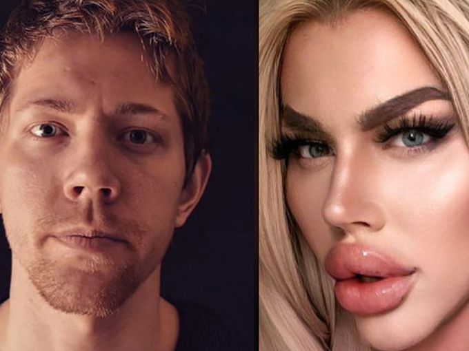 Той похарчи 50 000 лв. за пластични операции, за да се превърне в кукла Bratz