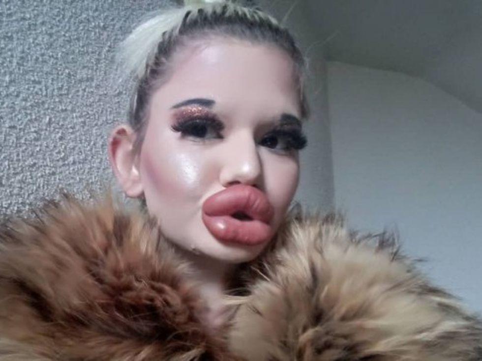 Българското Барби си подари 27-ата инжекция с хиалурон (снимки)