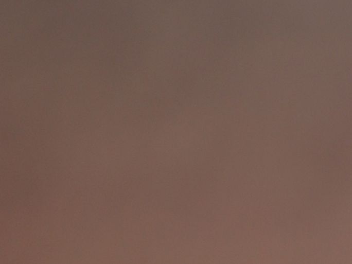 Така не сме я виждали никога: Джей Ло без грим и с рана на лицето си (Снимки)