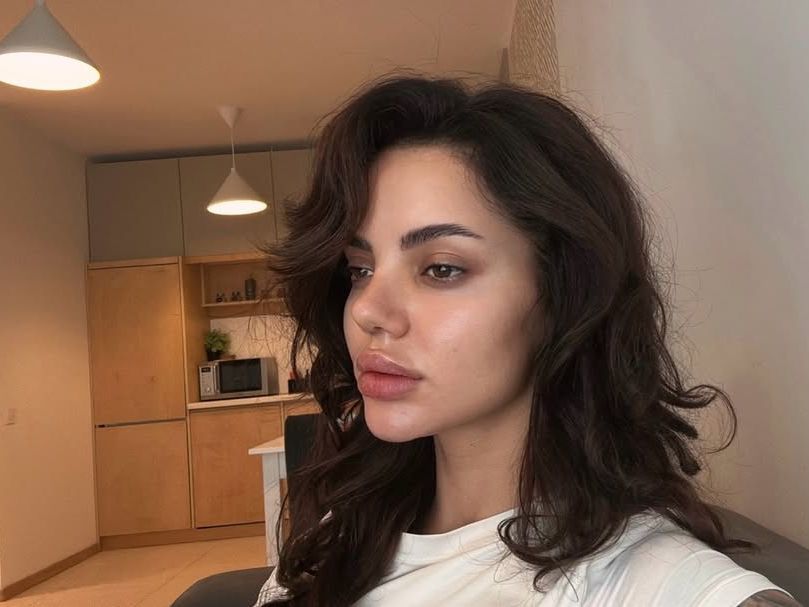 Един въпрос: ЗАЩО?! – Валерия Дакова разкрива истината за операцията на носа си (Снимки и Видео)