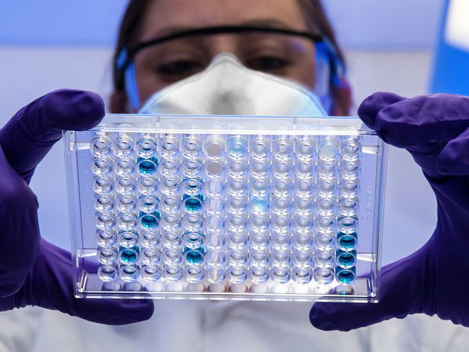 Проф. Аргирова коментира вируса Нипа: Ето какви са симптомите