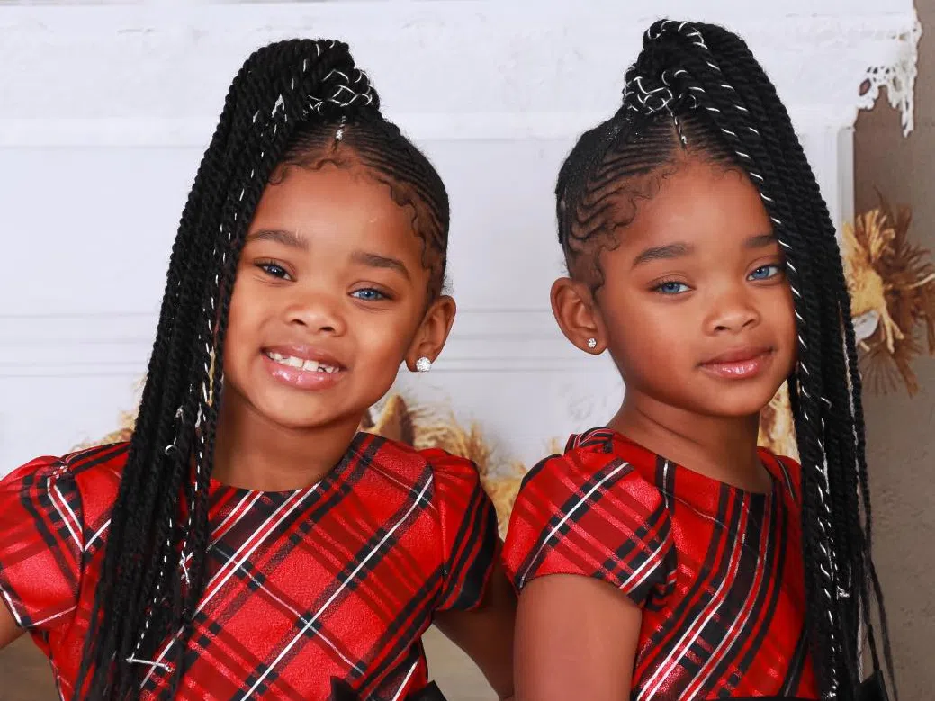 Уникално красиви: Генетична мутация направи тези 10-годишни близначки интернет сензация (снимки)